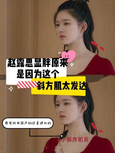 赵露思斜方肌怎么矫正(驼背斜方肌最快的恢复方法)