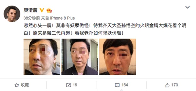 庾澄庆眼睛受伤