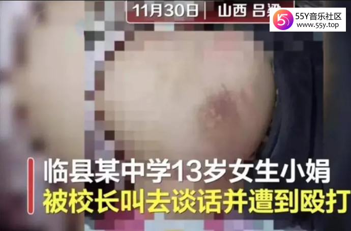 女生被校长殴打致伤